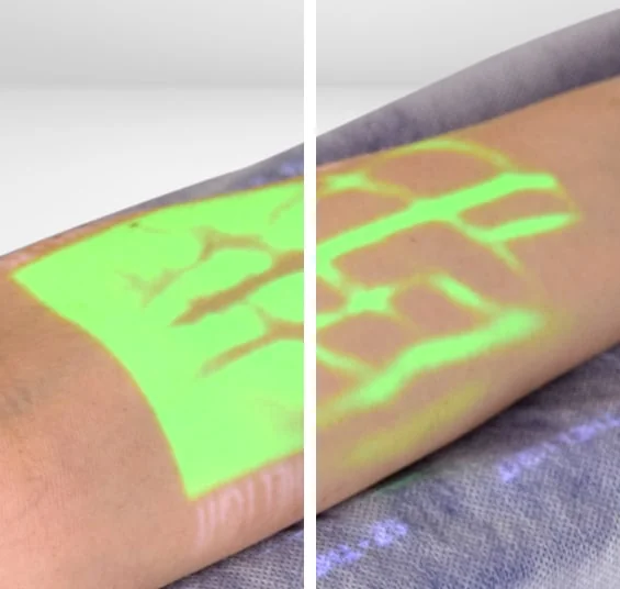 Sistem de vizualizare a venelor VV-100 - 3