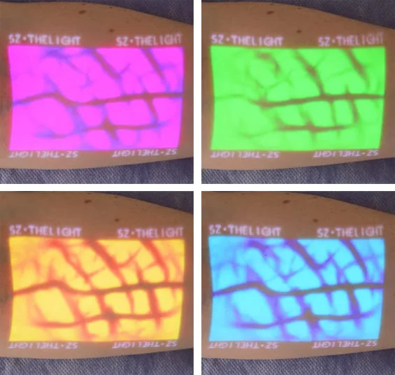 Sistem de vizualizare a venelor VV-100 - 4